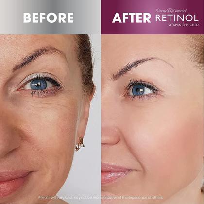 Imagem de Gel para os olhos Retinol Vitamina A Antienvelhecimento 15 mL com inchaço