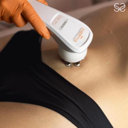 Imagem de Hertix Smart Slim KLD - Aparelho de Radiofrequência