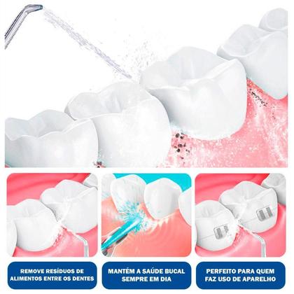 Imagem de Higienizador Bucal Elétrico Bivolt Limpeza Profunda Dente E