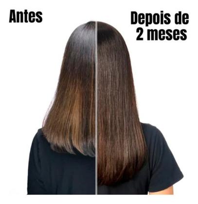 Imagem de Ilike Condicionador Crescimento Absoluto - 300ml