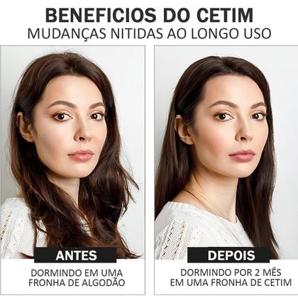 Imagem de Kit 2 Fronha De Cetim Com Aba Elegante Antifriiz Cabelo Capa