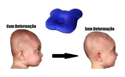 Imagem de Kit 2 Travesseiro Bebe Anatômico Almofada Amamentação Gemeos