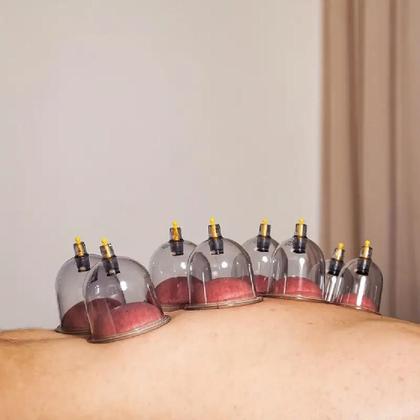 Imagem de Kit 24 ventosas terapia succao estetica ventosaterapia copos massoterapia acumputura chines