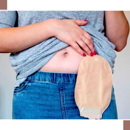 Imagem de Kit 3 Bolsas Colostomia Ostomia Com Filtro De Carvao 70mm