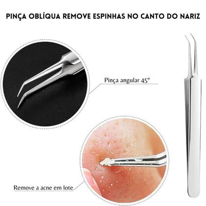 Kit 3 Pinças Aço Inox Para Remoção De Cravos Acnes Espinhas - Arte Seducao Imagem de Kit 3 Pinças Aço Inox Para Remoção De Cravos Acnes Espinhas