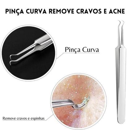 Kit 3 Pinças Aço Inox Para Remoção De Cravos Acnes Espinhas - Arte Seducao Imagem de Kit 3 Pinças Aço Inox Para Remoção De Cravos Acnes Espinhas