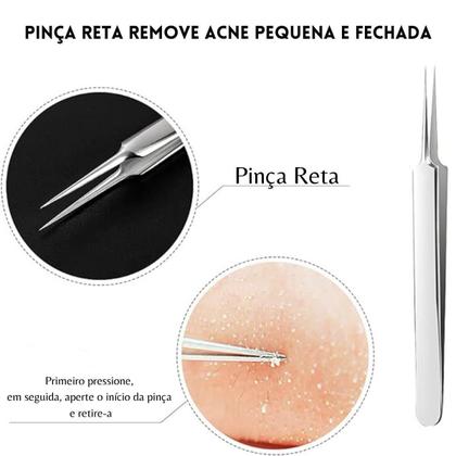 Kit 3 Pinças Aço Inox Para Remoção De Cravos Acnes Espinhas - Arte Seducao Imagem de Kit 3 Pinças Aço Inox Para Remoção De Cravos Acnes Espinhas