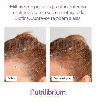 Imagem de Kit 3x Biotina Beauty Premium Cabelos Pele Unhas - 180 Caps Nutrilibrium