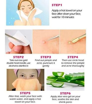 Imagem de Kit 4 Extrator Cureta Tira Acne Cravos E Espinha Limpeza