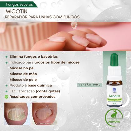 Imagem de Kit 4 Micotins 10ml Conta Gotas - Reparador Para Unhas