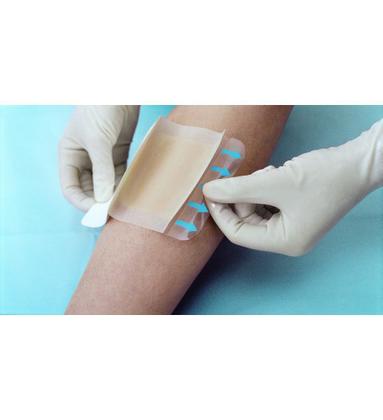 Imagem de Kit 5 Curativo Hidrocoloide 10x10cm - Kangli Derm G1318