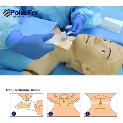 Imagem de Kit 5 Curativo Para Proteção Traqueostomia / Feridas 9x9cm
