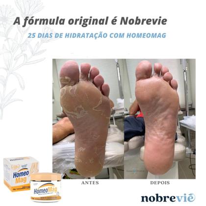 Kit 6 Creme de Hidratação para Pés Ressecados Calcanhar Rachados Homeo ...