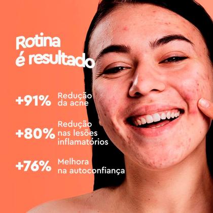 Imagem de Kit 6 Pomada para Espinhas Rosto Gel Secativo Antiacne Acnezil 10g Cimed Ácido Salicílico