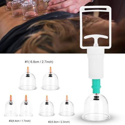 Imagem de Kit 6 Ventosas Com Bomba Ventosaterapia Massoterapia Chines