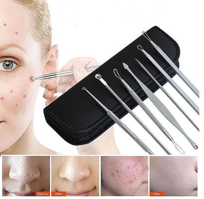 Imagem de Kit 7 Curetas Remove Cravos Espinhas Aço Inoxidável C/estojo