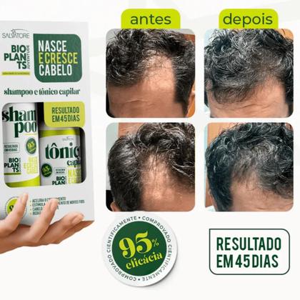 Imagem de Kit Bioplants Salvatore Nasce e Cresce Cabelos (Shampoo e Tônico)