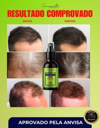 Imagem de Kit CapelliVip Crescimento Acelerado Anti Queda e Cabelo, Pele e Unhas 60 UN