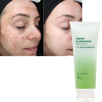 Imagem de Kit Clareador Corporal Virilha Axilia e Facial Rosa Mosqueta