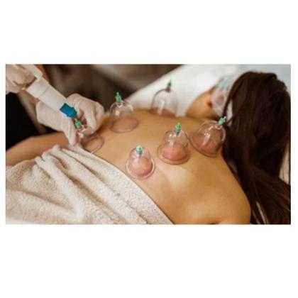Imagem de Kit com 12 Ventosas para Massagem: Ventosaterapia, Acupuntura e Massoterapia - Envio Imediato!