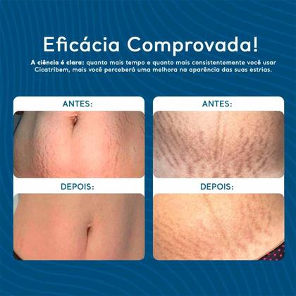 Kit Cicatribem Completo