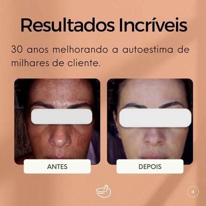 Imagem de Kit Creme Facial Clareador Nova Pele 25g Protetor Solar Nova Pele Fps 50 100ml