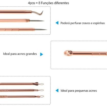 Imagem de Kit Extrator de Cravos e Espinhas em Aço Inox Profissional Limpeza de Pele