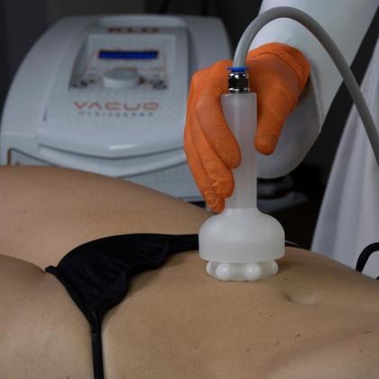 Imagem de Kit Hygiadermo Vácuo KLD + Peeling + Caneta Extratora + Pump