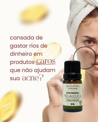 Imagem de Kit Leite de Magnésia e OE Melaleuca 10ml belezantu