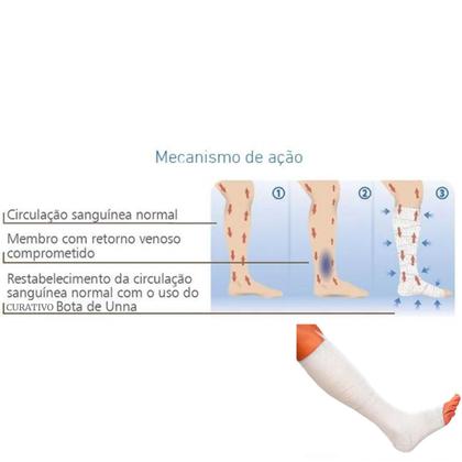 Imagem de Kit Para Diabéticos Feridas Perna Bota Unna + Óleo Dermatrol