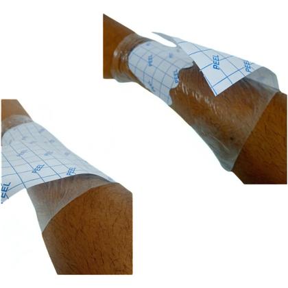 Imagem de Kit Para Feridas Machucados Curativos 02 Alginato Calcio + Filme Adesivo Protetor 10cm x 1mt