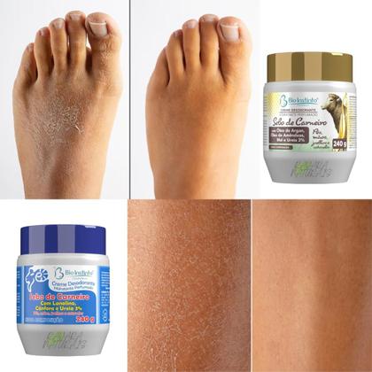 Imagem de Kit Sebo de Carneiro com Óleo de Argan, Óleo de Amêndoas, Mel, Lanolina, Cânfora e Ureia 480g