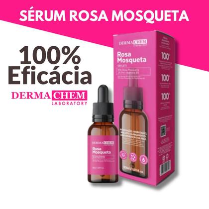 Imagem de Kit Skincare Anti Oleosidade Acne Para Peles Oleosas E Um Sérum Rosa Mosqueta Ultra Hidratante E Clareador De Manchas