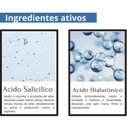 Imagem de Kit Skincare Anti Oleosidade Acne Para Peles Oleosas E Um Sérum Rosa Mosqueta Ultra Hidratante E Clareador De Manchas