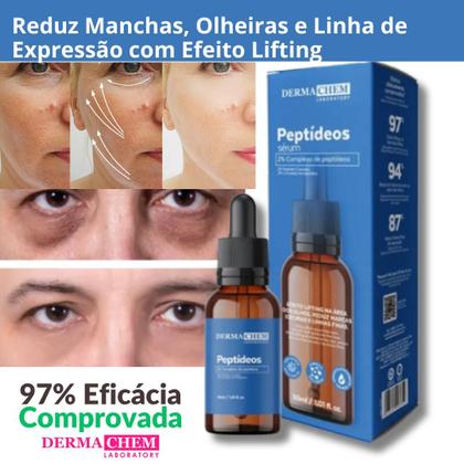 Imagem de Kit Skincare Anti Oleosidade E Acne , Sérum Peptídeos Anti olheiras e Rugas Dermachem 5 ITENS