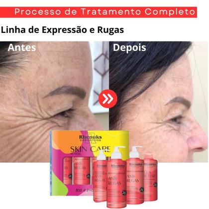 Imagem de KIT Skincare Anti Rugas Rhenuks , Sérum Clareador de Manchas ,Protetor Solar Facial sem cor FPS60 Dermachem