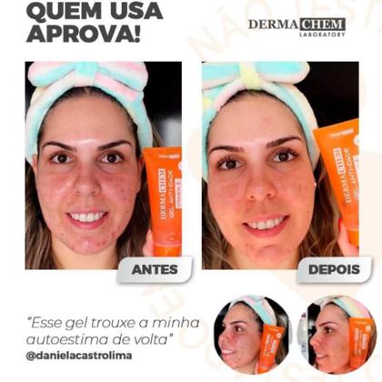 Imagem de Kit Skincare Vitamina C Anti Idade Clareador Dermachem, Mousse Micelar Limpeza Facial Vitamina C