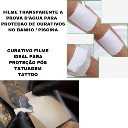 Imagem de Kit Tratamento De Machucados Lesão 1 Hidrocoloide + 1m Filme Adesivo
