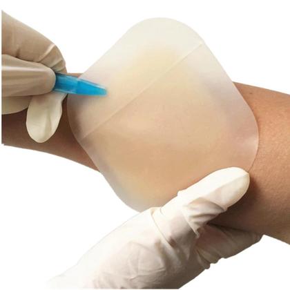 Imagem de Kit Tratamento De Machucados Lesão 1 Hidrocoloide + 1m Filme Adesivo