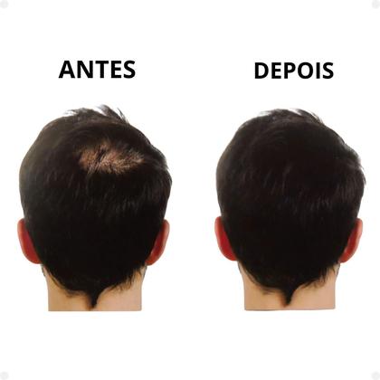 Imagem de Kit Vertix: Fibra Capilar Castanho Escuro e Aplicador