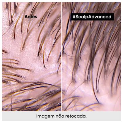 Imagem de L'oréal Expert Scalp Advanced Dermo-purifier - Shampoo 300ml