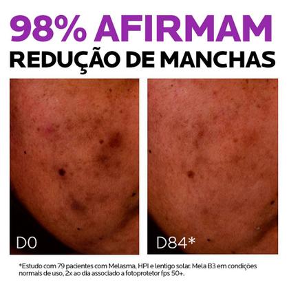 Imagem de La Roche-Posay Mela B3 Sérum Facial Antimanchas 30ml