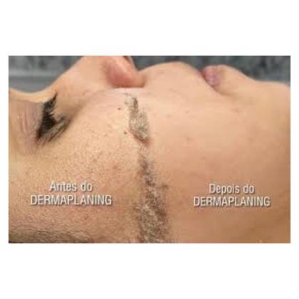 Imagem de Lâmina de sobrancelha dermaplaning removedor pelos 3 navalhas
