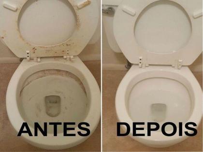 Imagem de Limpador Desincrustante para Louça Sanitária 500mL Duratto