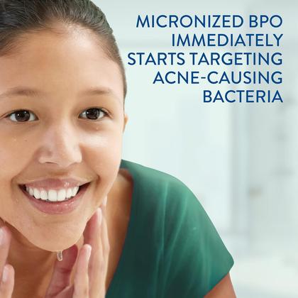 Imagem de Limpador Facial Cetaphil Gentle Clear Complexion com 2,6% de BPO - 125ml