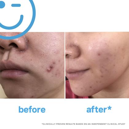 Imagem de Limpador Facial Kate Somerville EradiKate com 3% de Enxofre - 120ml