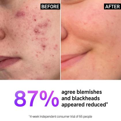 Imagem de Limpador Facial The INKEY List com Ácido Salicílico 150ml - Para Manchas