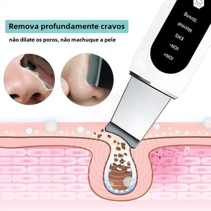 Imagem de Limpeza Profunda Do Rosto Purificador Ultrassônico Da Pele Removedor De Cravo Limpador De Poros Pá