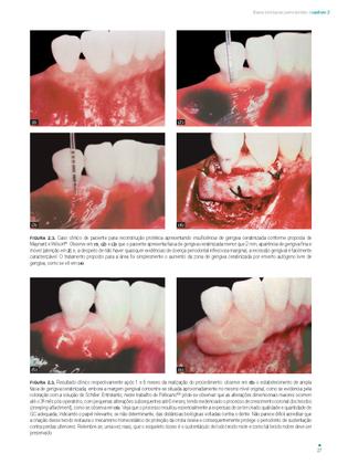 Imagem de Livro - Distâncias Biológicas Periodontais