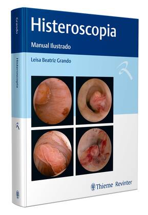 Imagem de Livro - Histeroscopia
